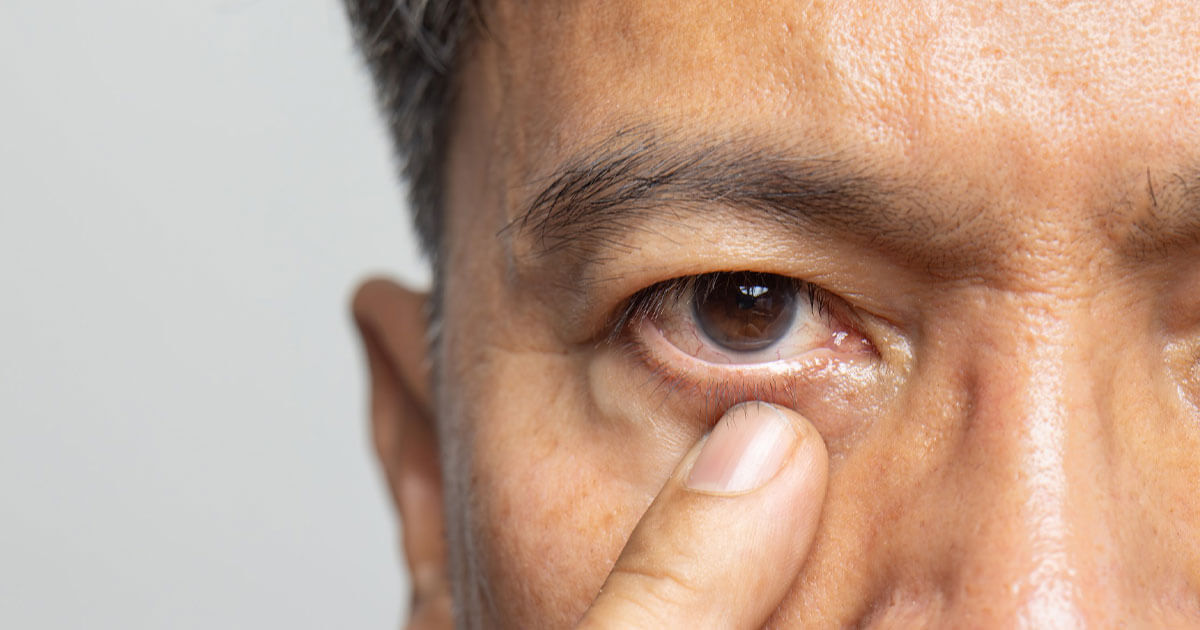 Living with Nystagmus: A Personal Journey